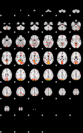 Patient:39;component:102