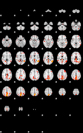 Patient:39;component:107