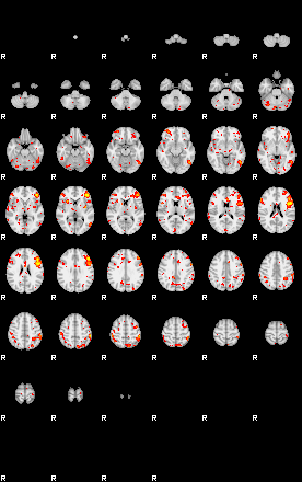 Patient:39;component:109