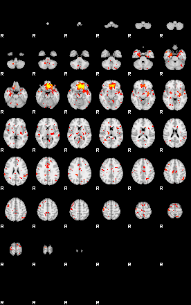 Patient:39;component:144