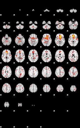 Patient:39;component:150