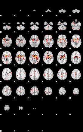 Patient:39;component:174