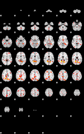 Patient:39;component:180