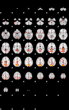 Patient:39;component:182