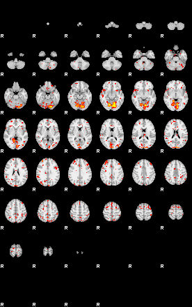 Patient:39;component:191