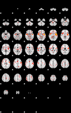 Patient:39;component:195