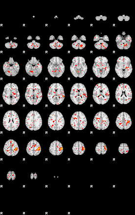 Patient:39;component:21