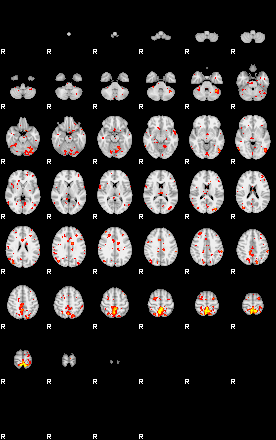 Patient:39;component:84