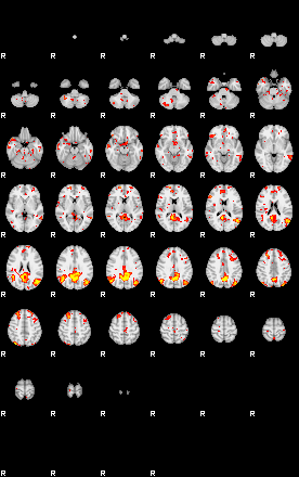 Patient:39;component:93