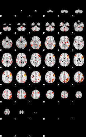 Patient:3;component:109