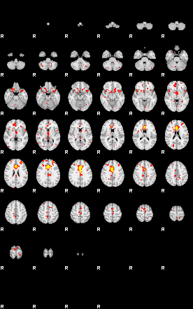 Patient:3;component:125