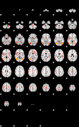 Patient:3;component:143