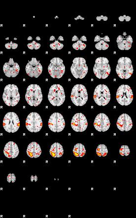 Patient:3;component:150