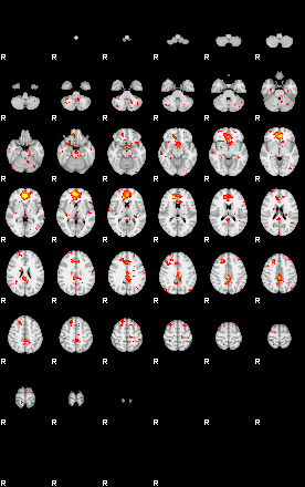 Patient:3;component:180