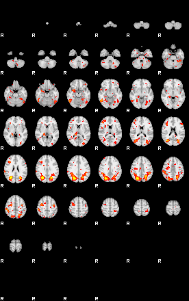 Patient:3;component:182