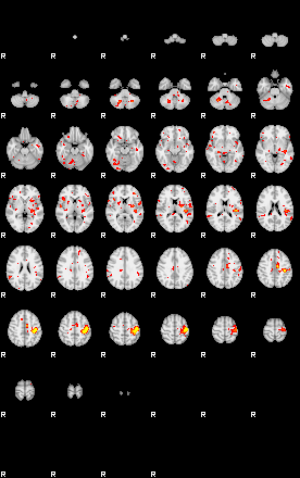 Patient:3;component:21