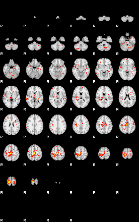 Patient:3;component:26