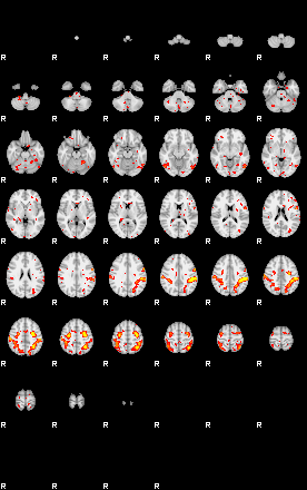 Patient:3;component:60