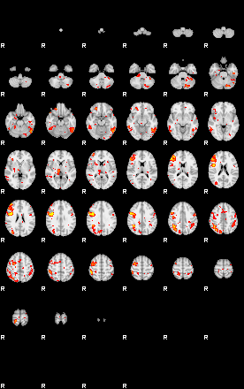 Patient:3;component:75