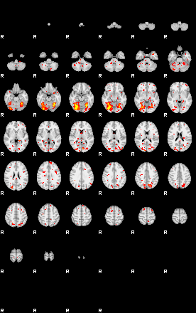 Patient:40;component:122