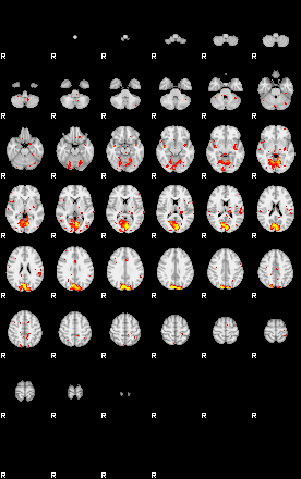 Patient:41;component:102