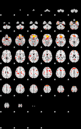 Patient:41;component:108