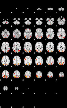 Patient:41;component:143