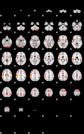 Patient:41;component:150