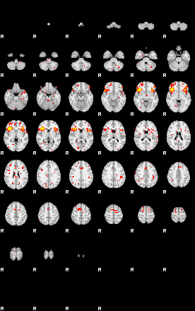 Patient:41;component:151