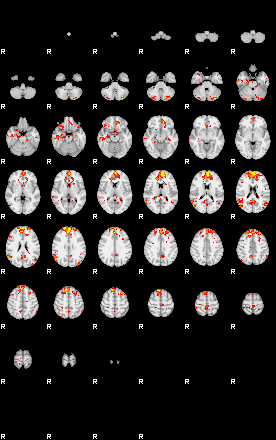 Patient:41;component:155