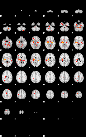 Patient:41;component:159