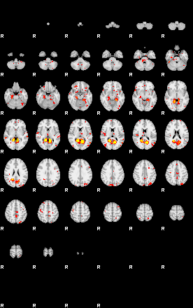 Patient:41;component:161