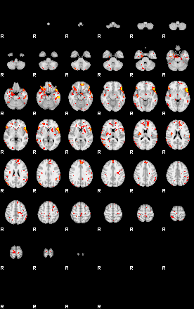 Patient:41;component:164