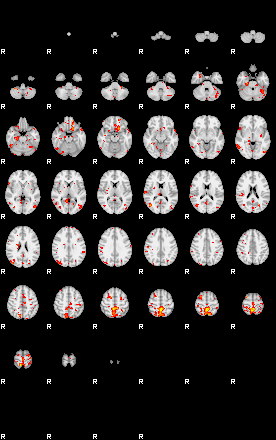 Patient:41;component:166