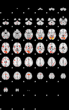 Patient:41;component:171