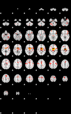 Patient:41;component:174