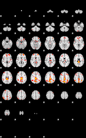 Patient:41;component:180