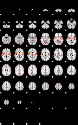 Patient:41;component:186