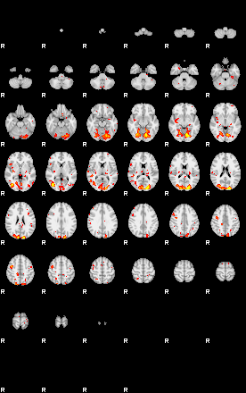 Patient:41;component:191