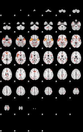 Patient:41;component:195