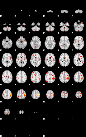 Patient:41;component:21