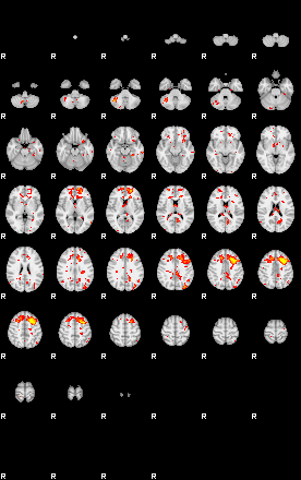 Patient:41;component:23