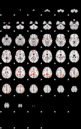 Patient:41;component:3