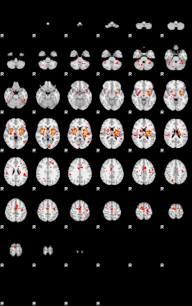 Patient:41;component:39