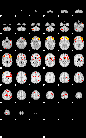 Patient:41;component:42