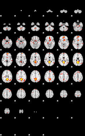 Patient:41;component:49