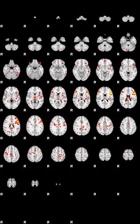 Patient:41;component:6