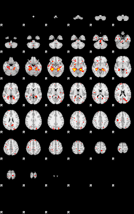 Patient:41;component:68