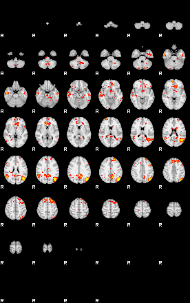 Patient:41;component:93