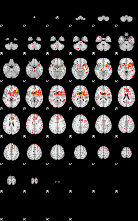 Patient:42;component:11